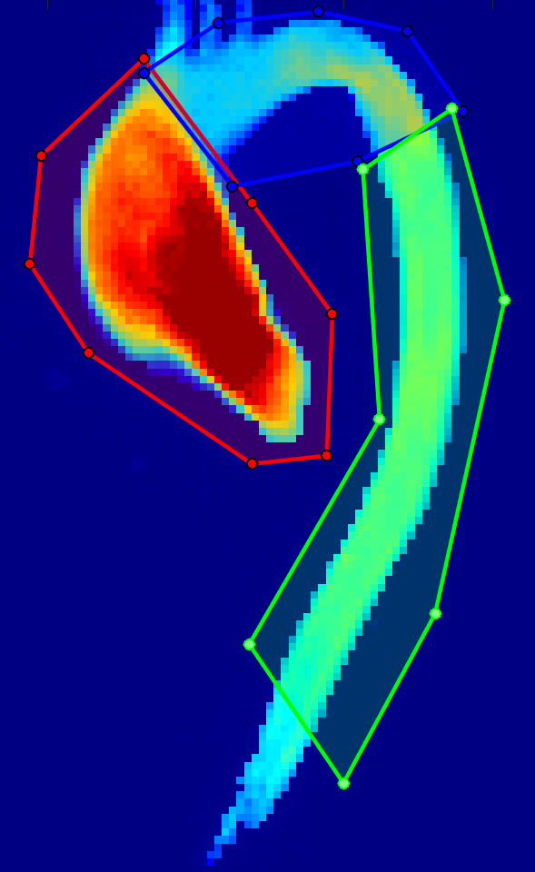 Company-supplied aortic blood-flow map