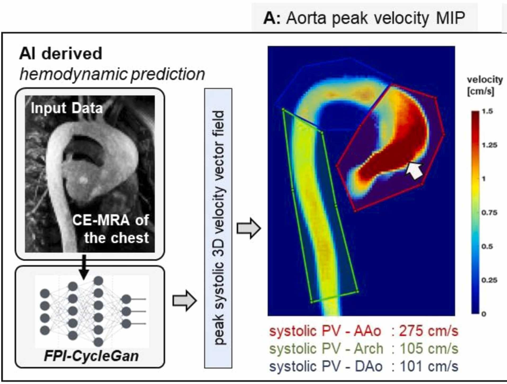 Example contrast-enhanced MR angiography input and corresponding study-generated peak-systolic aortic velocity map shown in Figure 3A.